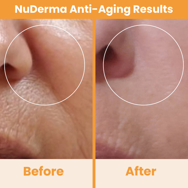 #benefit_anti-aging