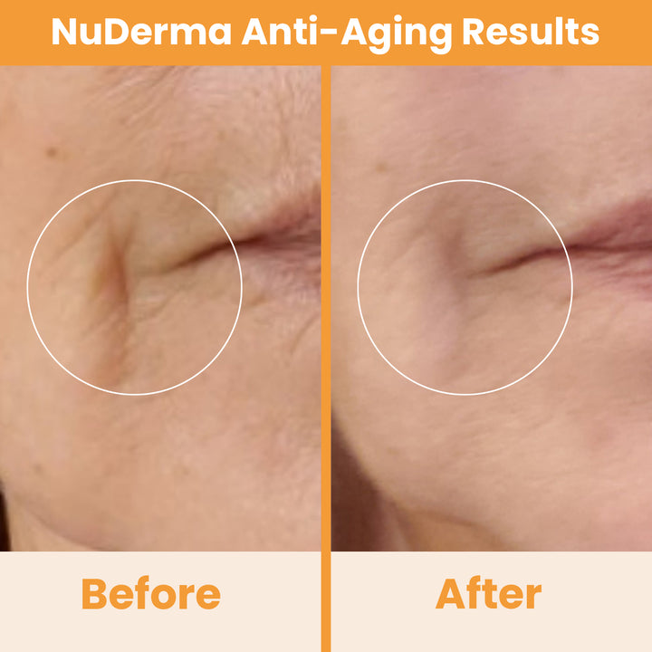 #benefit_anti-aging